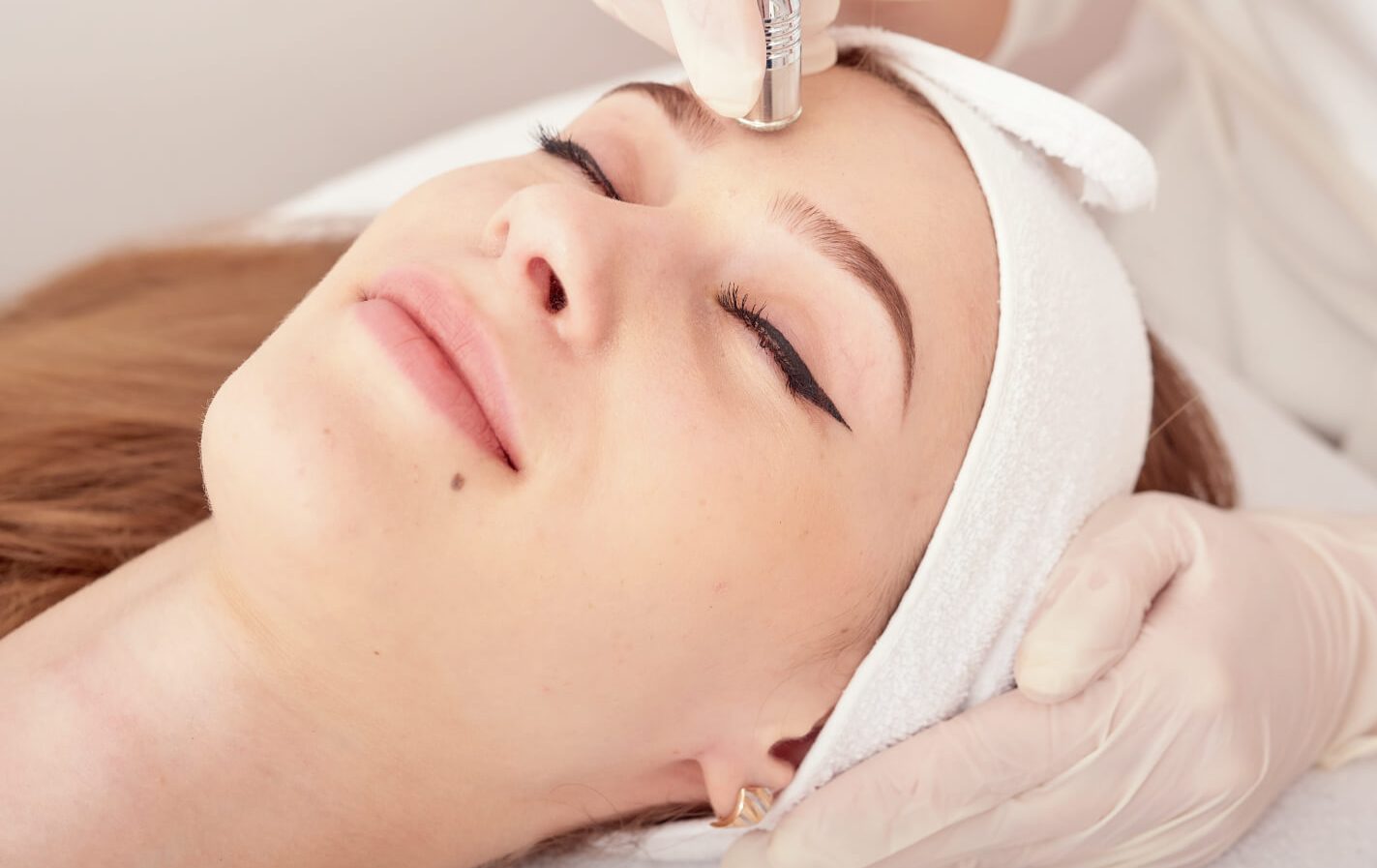 woman getting a microneedling procedure woman getting a microneedling procedure