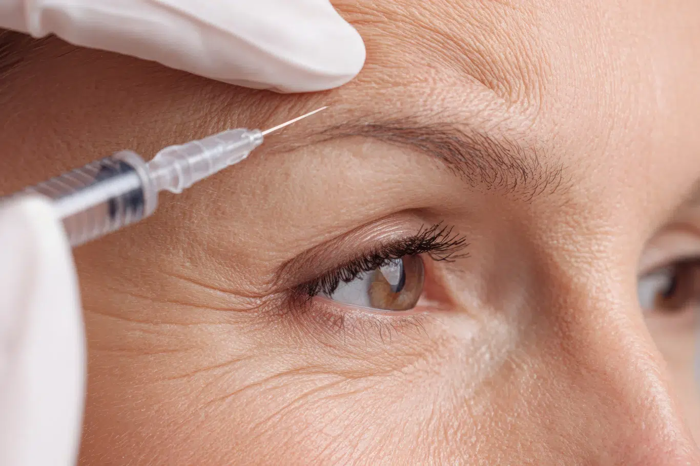 Closeup of mature woman receiving anti wrinkle injection in forehead area during cosmetic procedure